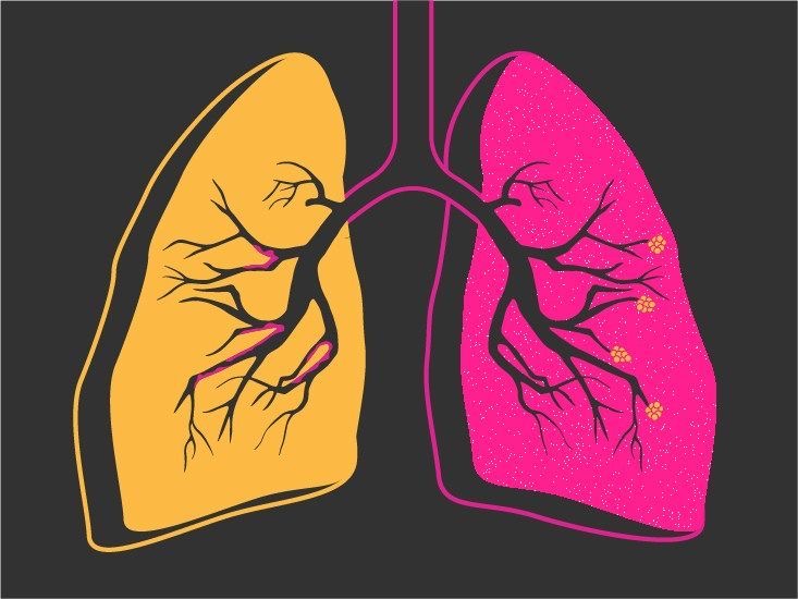 التنفّس: مهارة رياضية وحياتية هامة!